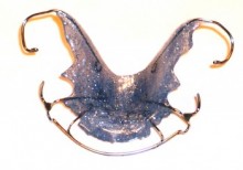 New_Retainer