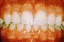 Periodontics