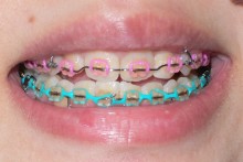 ortho01