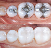 Before and After