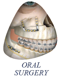Oral Surgery