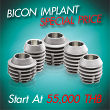 Promotion dental implant