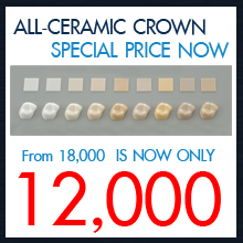 Promotion dental implant
