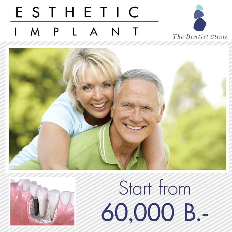 Promotion dental implant